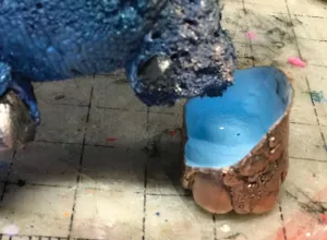 Blue baby prosthetic